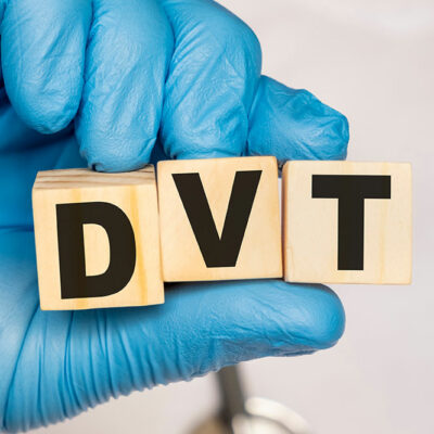 5 Treatment Options to Manage DVT