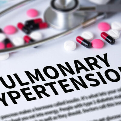 6 Facts on Pulmonary Arterial Hypertension