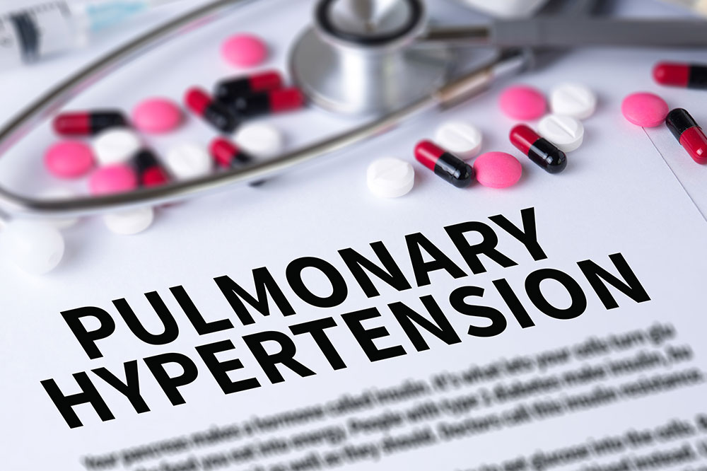6 Facts on Pulmonary Arterial Hypertension