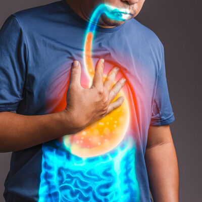 6 Risk Factors for GERD