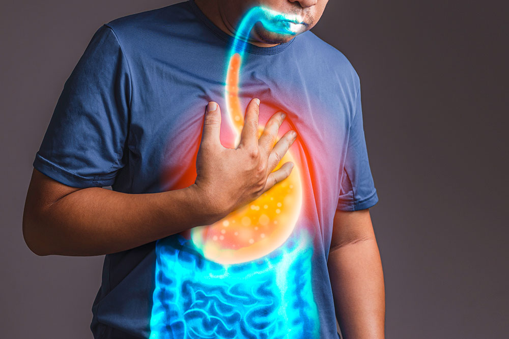 6 Risk Factors for GERD