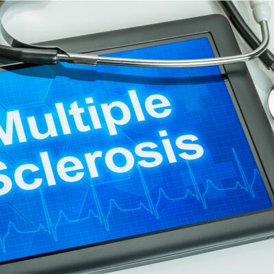 10 Common Symptoms of Multiple Sclerosis