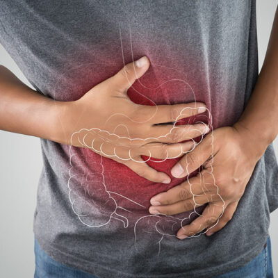 Major Gender-based Differences in Colon Cancer