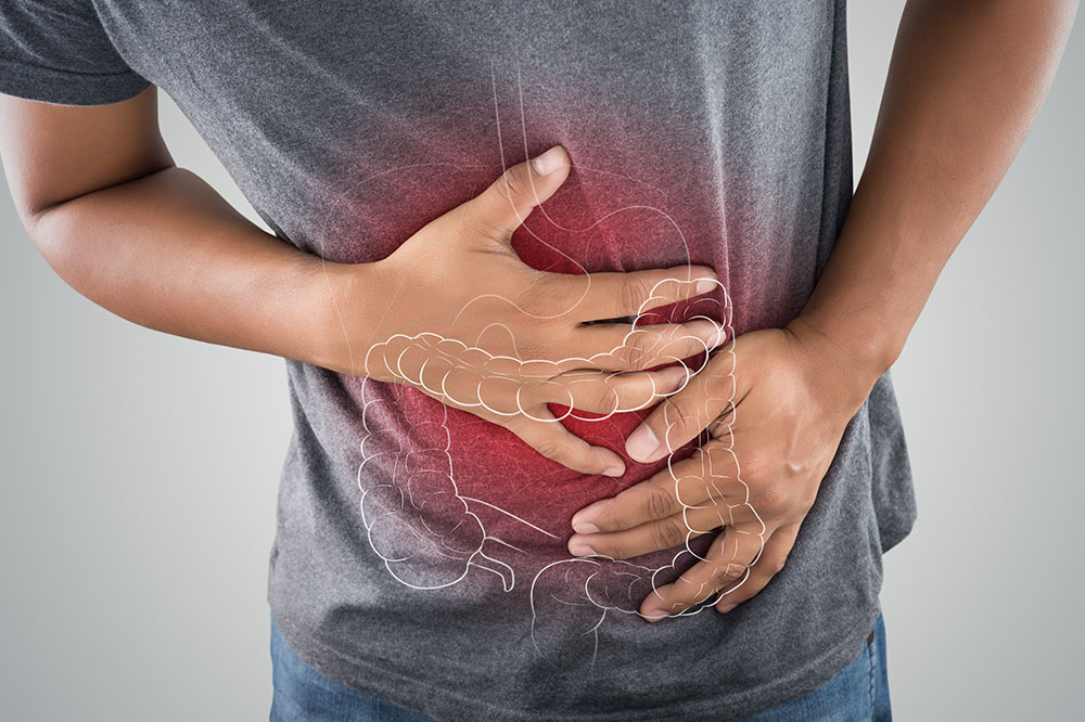 Major Gender-based Differences in Colon Cancer